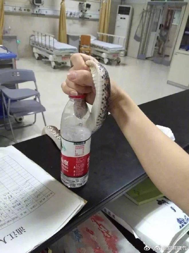 Đang đi dạo bị rắn cắn, cô gái trẻ đẹp túm cổ con rắn, quấn vào tay mang đến bệnh viện cấp cứu-4