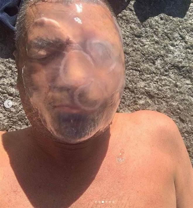 Người đàn ông liều mạng đội sứa độc lên đầu để câu view, sinh nhật đăng video 'Tôi vẫn chưa chết', 5 ngày sau đã qua đời 2